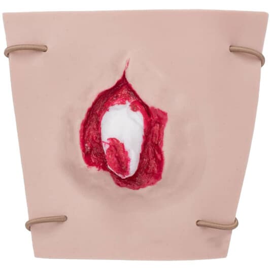 Муляж EasyPractice открытый перелом НФ-00001936