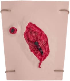 Муляж EasyPractice уламкового поранення НФ-00001945