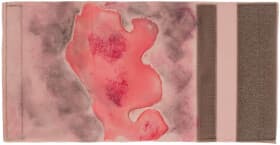 Муляж EasyPractice ожог конечности 2-3 степени НФ-00001952