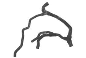 Патрубок радиатора системы охлаждения двигателя