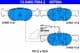 13.0460-7064.2 ATE Гальмівні колодки